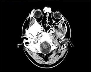 Brain Scan Brain Scan